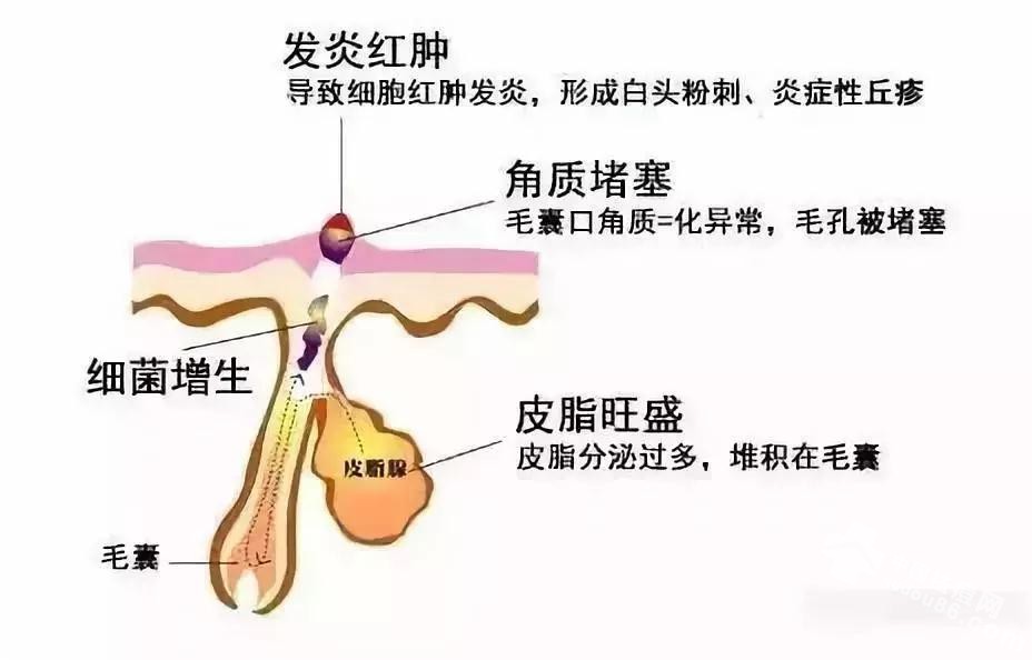 <a  data-cke-saved-href=http://www.qudou86.com/tag/heitou/ href=http://www.qudou86.com/tag/heitou/ target=_blank >ͷ</a>ȥΪֹ<a  data-cke-saved-href=http://www.qudou86.com/tag/heitou/ href=http://www.qudou86.com/tag/heitou/ target=_blank >ͷ</a>